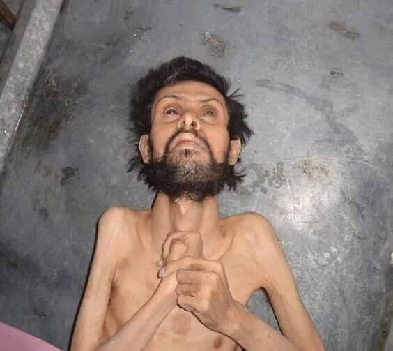 شام میں بدترین حالات، 23 محصورشہری بھوک سے ہلاک