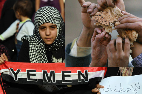 یمن میں خانہ جنگی کے سبب شدید غذائی بحران .بیماریوں میں اضافہ