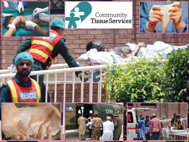 سانحہ بہاولپور کے متاثرین کیلئے خوشخبری‘ امریکی این جی اوز جھلسے ہوئے لوگوں کو جلد کا عطیہ دیگی