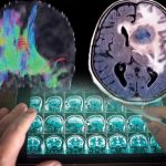 ریو وائرس تھیراپی ۔کینسر کا علاج