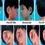 چینی سائنسدانوں نے مصنوعی کان  تیارکرکے دنیاکوحیران کردیا