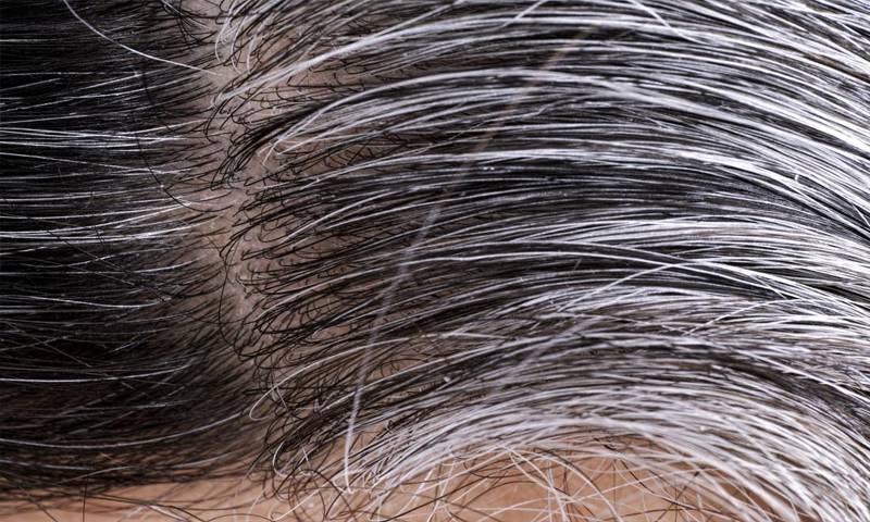 قبل از وقت سفید بال خطرناک بیماری کی علامت ہے، ماہرین