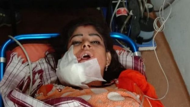 بھارت ، ڈانس کرتے کرتے رکنے پر لڑکی کو گولی مار دی گئی