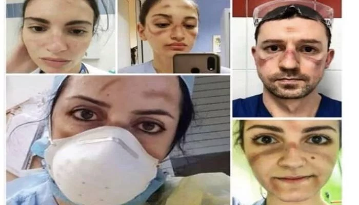 اٹلی کے ڈاکٹروں کی دنیا بھر میں تعریف،تصاویر سوشل میڈیاپر وائرل