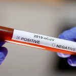 سعودی عرب میں کروونا کے 15 نئے کیسز سامنے آ گئے ، مجموعی تعداد 133 ہو گئی