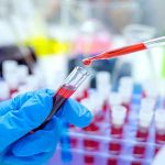 قطر میں کورونا کے 439 اور ترکی میں 18 کیسوں کی تصدیق ہو گئی