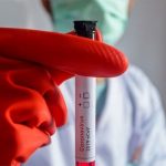 کووڈ 19 کے بغیر علامات والے مریضوں کا مدافعتی ردعمل کمزور ہونے کا انکشاف