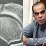 سندھ اسمبلی دھکم پیل، مکیش چاولہ ہیئرلائن فریکچر کا شکار