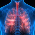 کووڈ کے بعد پھیپھڑوں کو طویل المعیاد نقصان پہنچنے کی تصدیق