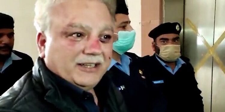 محسن بیگ کا 3 روزہ جسمانی ریمانڈ منظور، پولیس کے حوالے