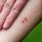 تھرپارکر، 3 دن میں 60 افراد کو سانپ نے ڈس لیا